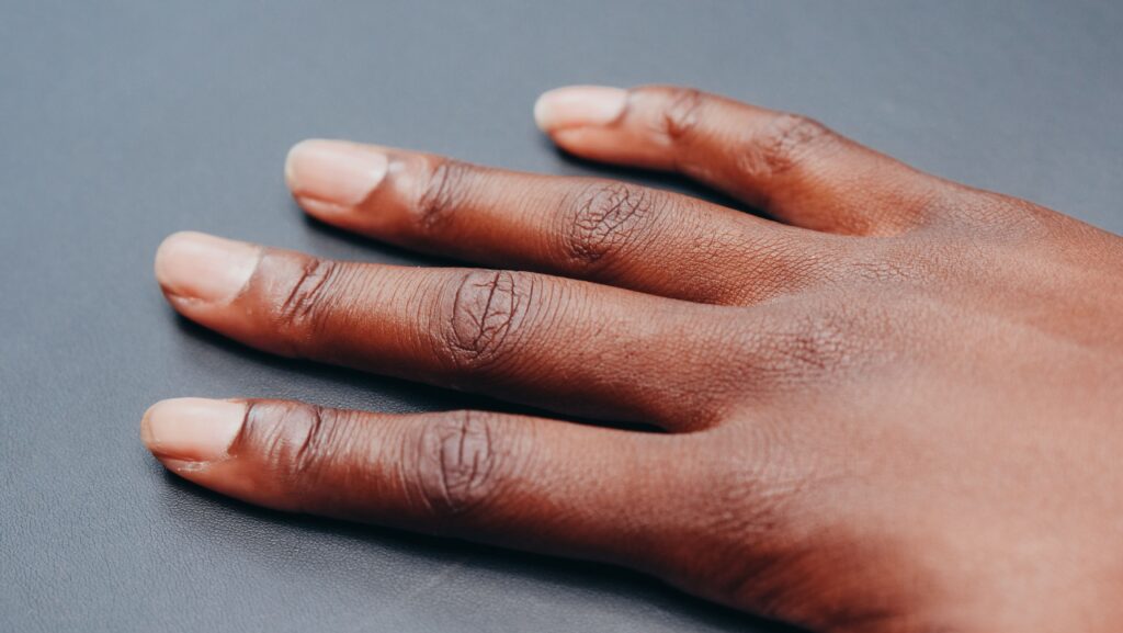 Why Are My Hands So Dry Even When I Moisturize? Here’s 4 Reasons Detailed close-up image of a hand and fingers against a neutral background.