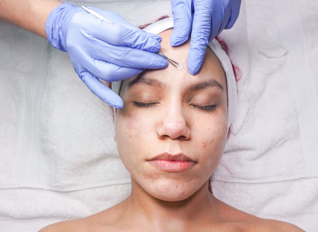 Does Oil Cleansing Help With Blackheads? Woman undergoing professional facial treatment with eyes closed and gloves.