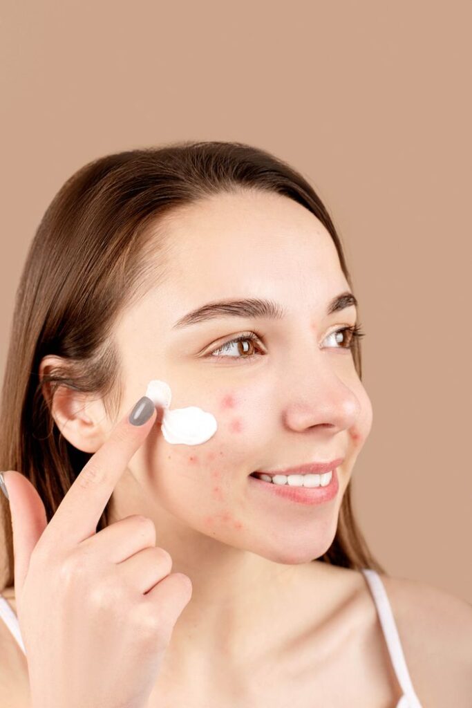 pexels photo 6475982 6475982 1 Young woman smiling while applying cream to acne-affected skin, promoting skincare routine.