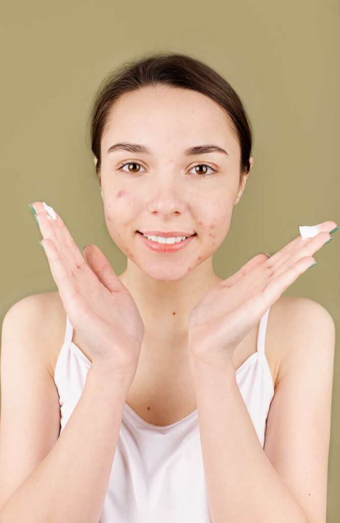 How to Get Rid of Redness from Acne: Fast and Lasting Ways Teenager applying skincare cream showing confidence and natural beauty.