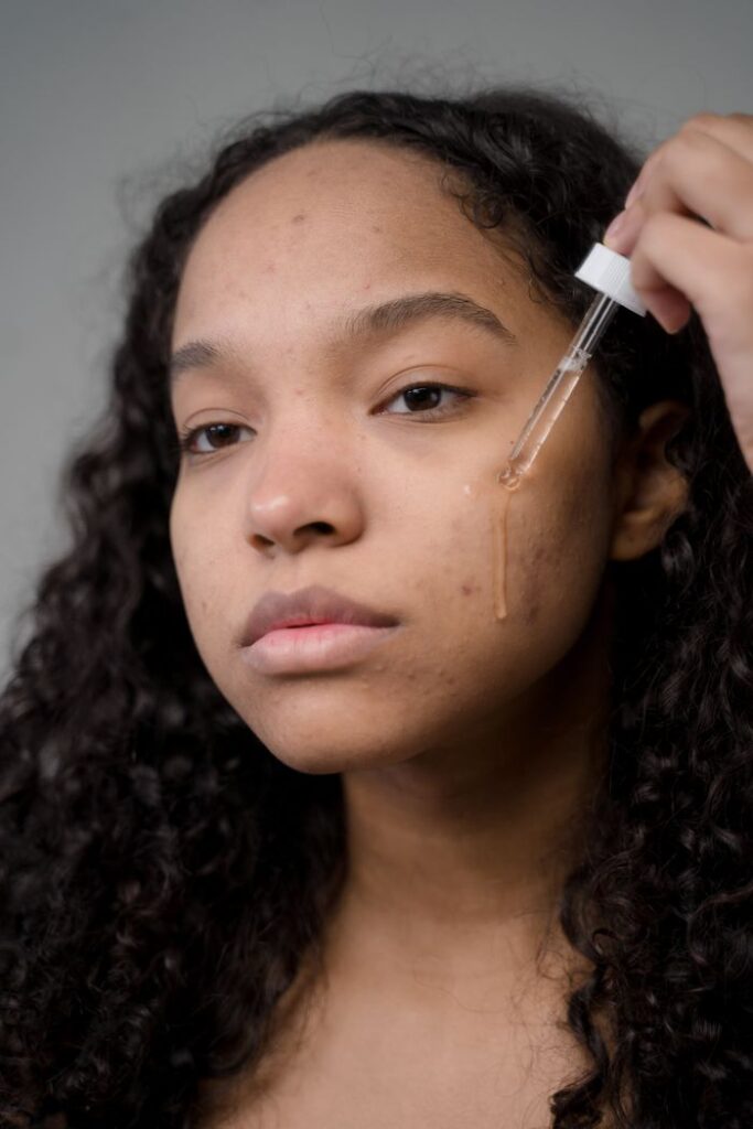 Best Skincare Routine for Acne-Prone Skin Portrait of a woman applying serum to enhance skin texture and glow.